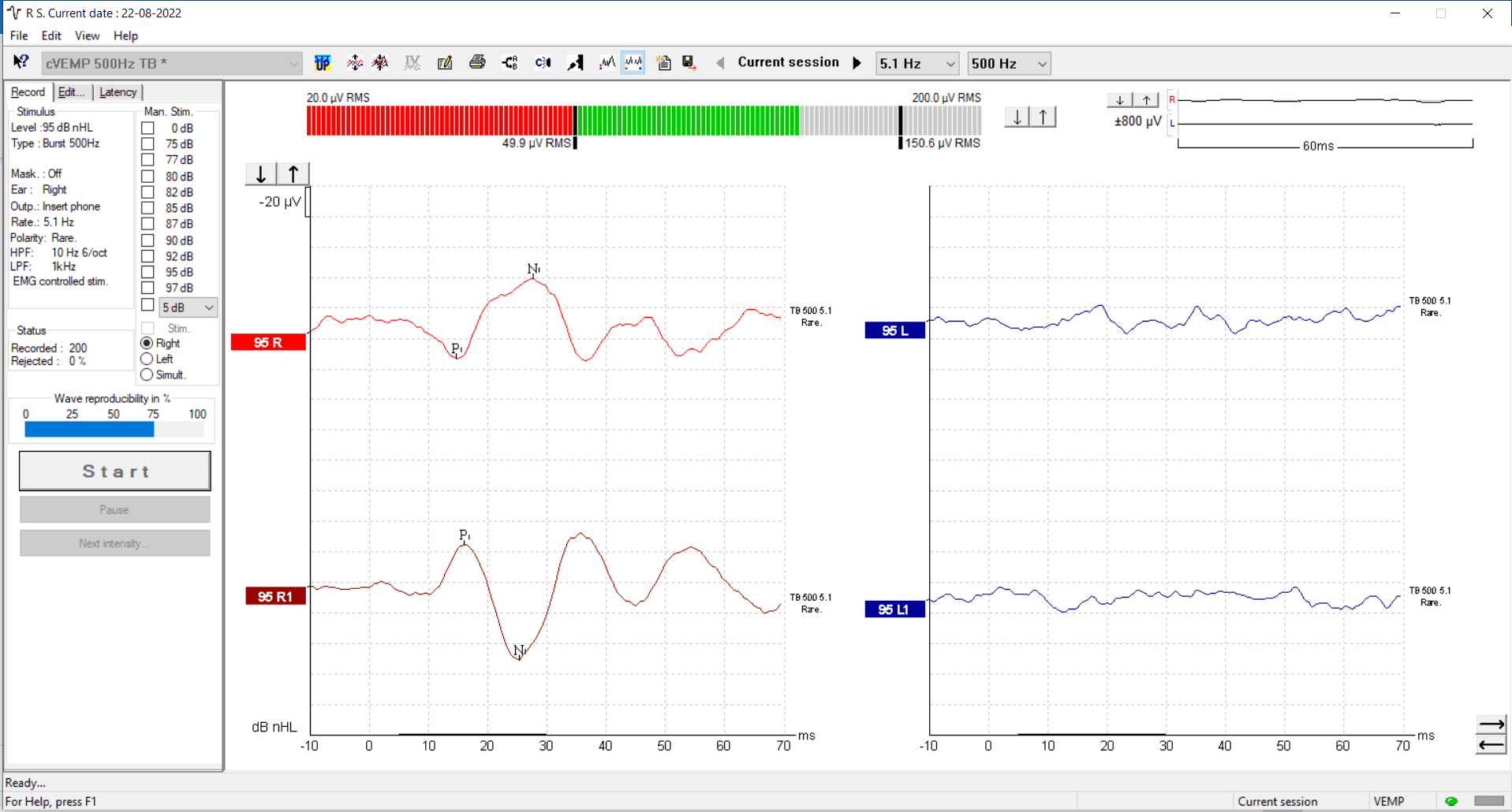 EclipseVEMP_test_Annette Kjaer Knudsen-1bb5b1bf.png