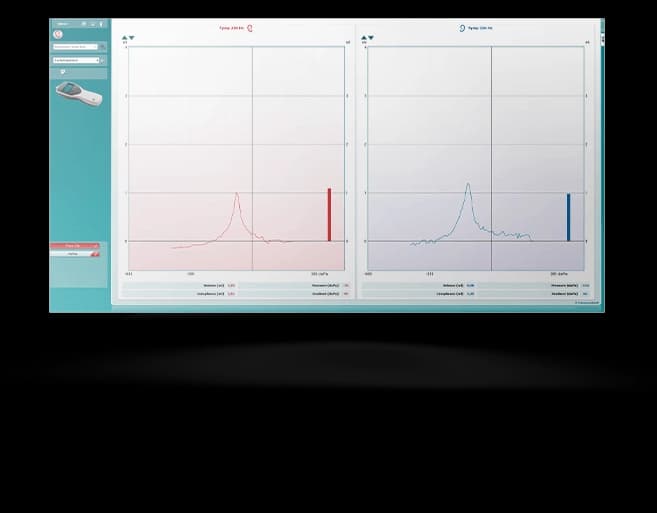 226 Hz tympanograms displayed in MT10 software