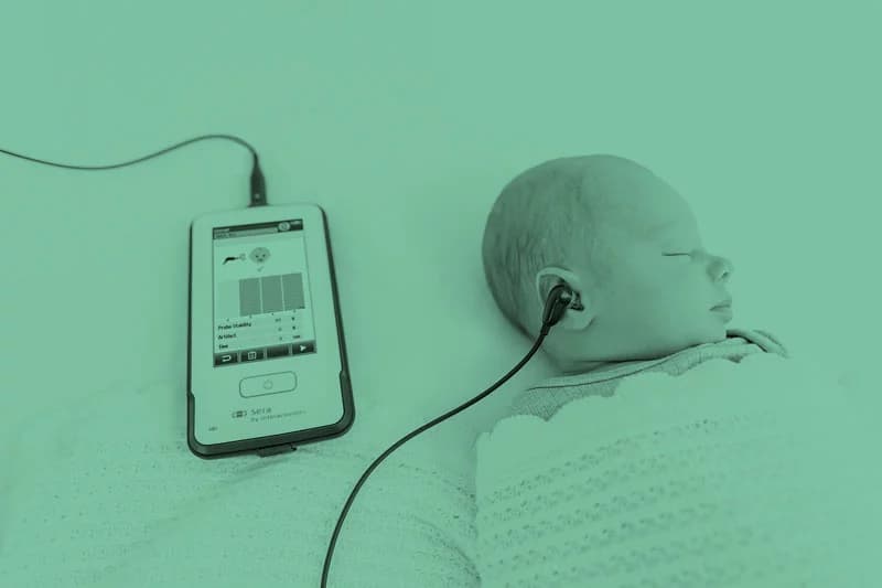 Sleeping baby with Sera SnapPROBE inserted into right ear